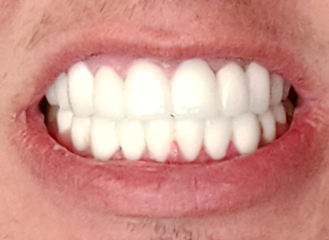 IMG 20220405 160925