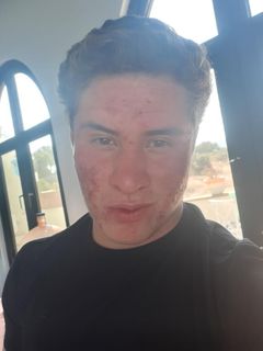 2872733 face1