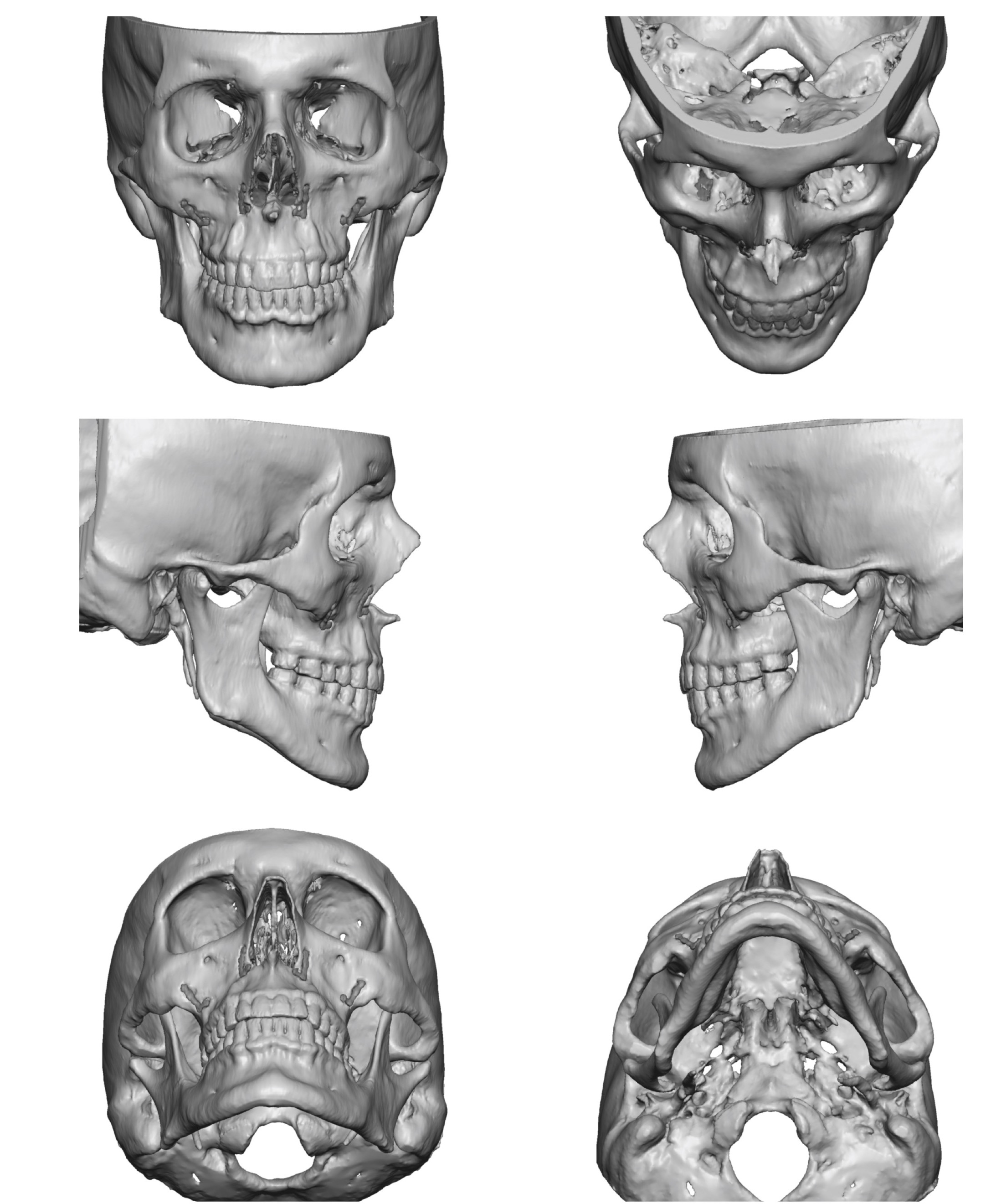 Skull Hi Res