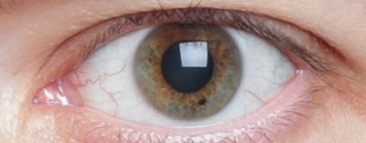 Eye