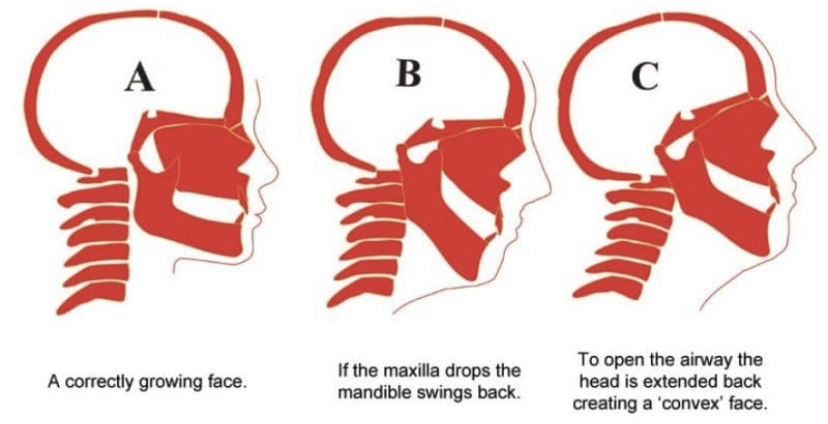 E5DA8160 5300 4044 929C B8AADECFF022