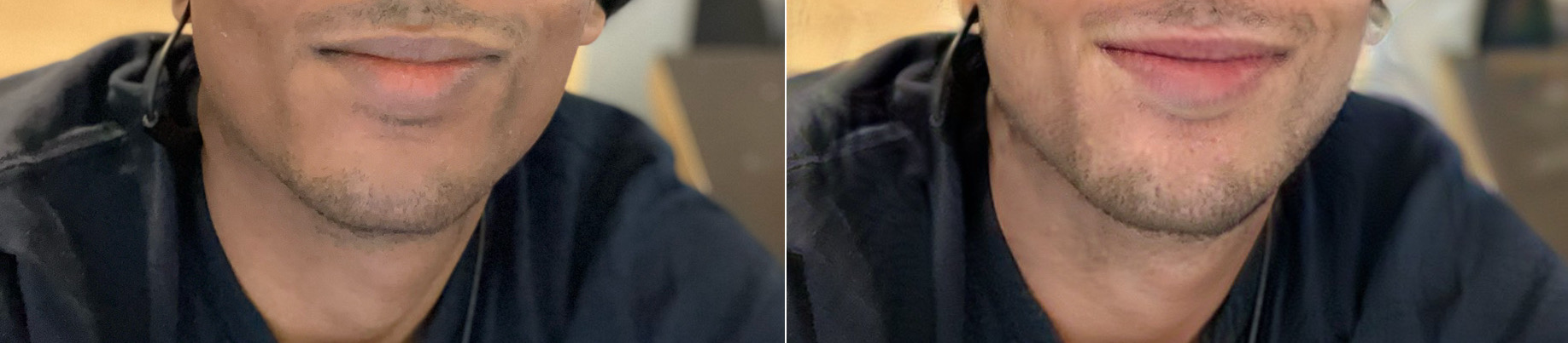 2893623 IMG 0300