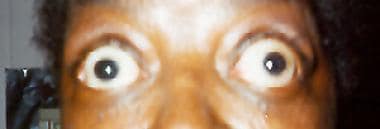 B3BD4874 45DC 4DCF BF8F 43EF75D90880