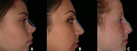 IMG 20201225 152419 042