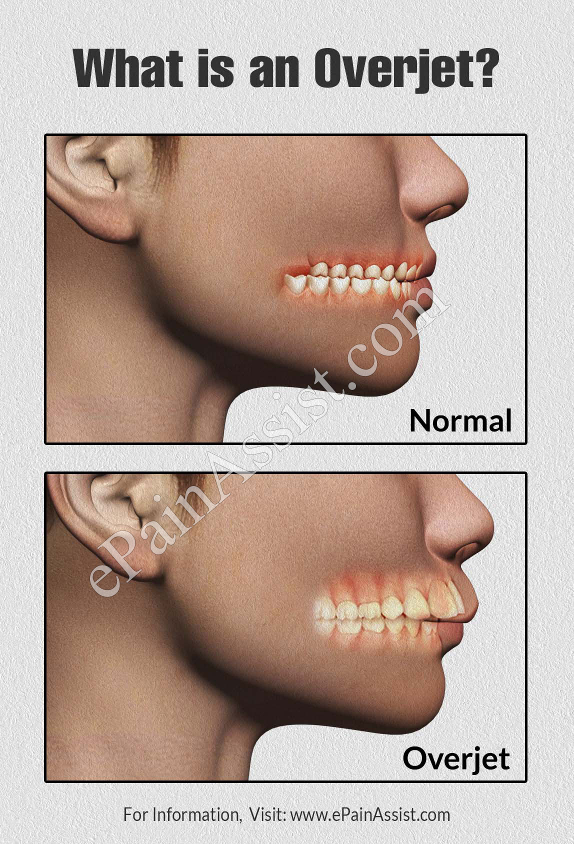 D30984EA A581 4069 9DDF 339CD4C2E921