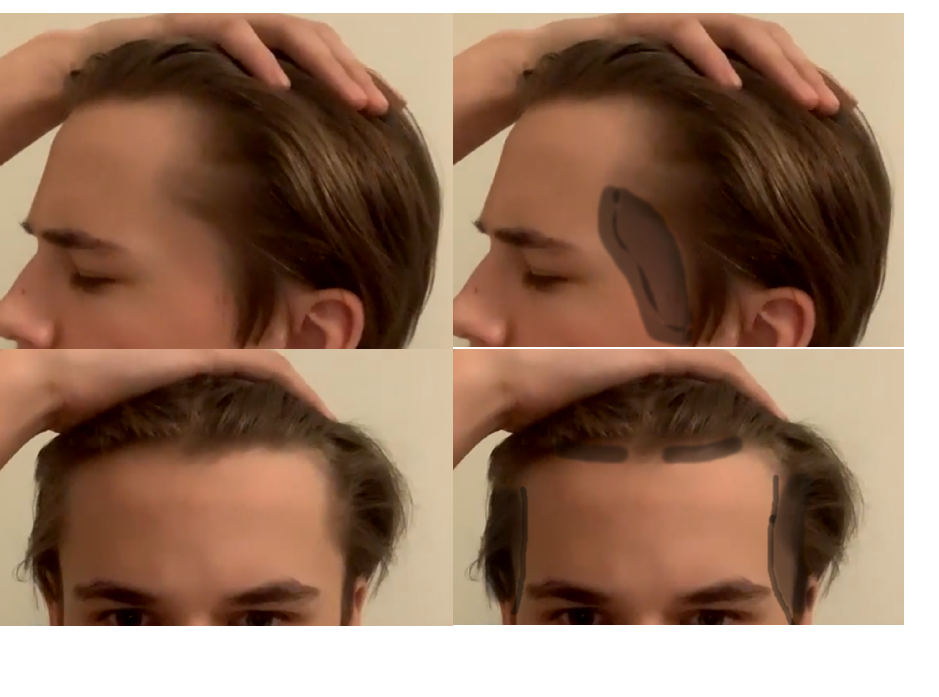 Hairline