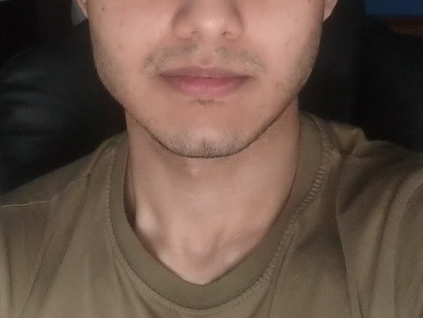 Normal