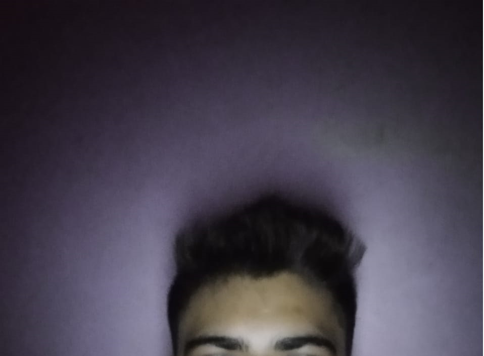 Hairline