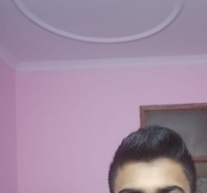 Hairline3