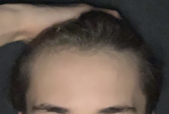A4213389 1BE9 467A B684 F21185447AF0