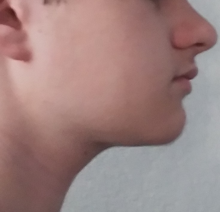 20220529 0706542