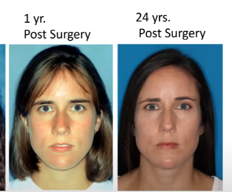 2892918 tmj part 2
