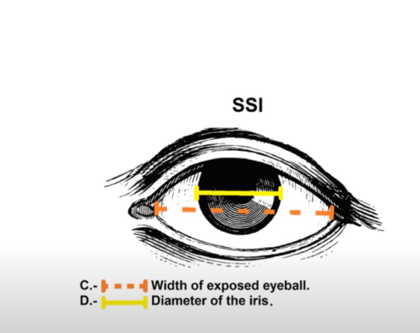 SSi
