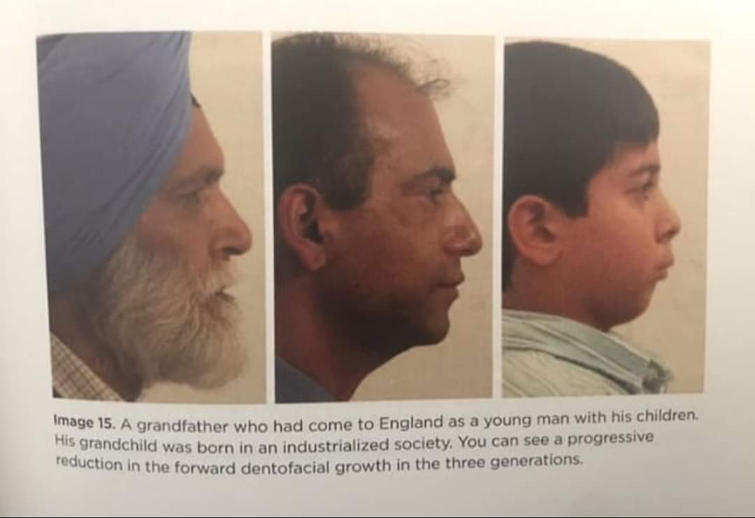 3gens