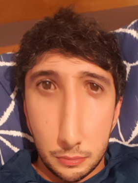 Midface mogger