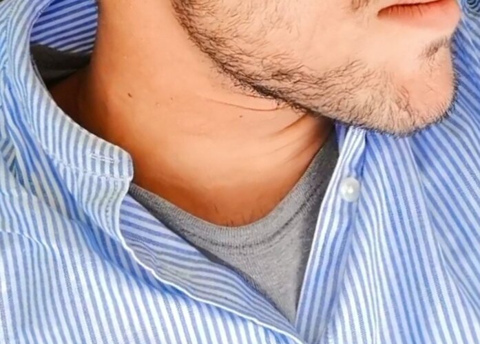 currylightskinmandible.jpg