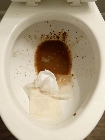 horrible-severe-diarrhea.jpg