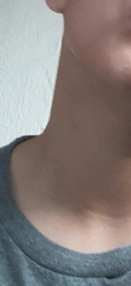 202003399493