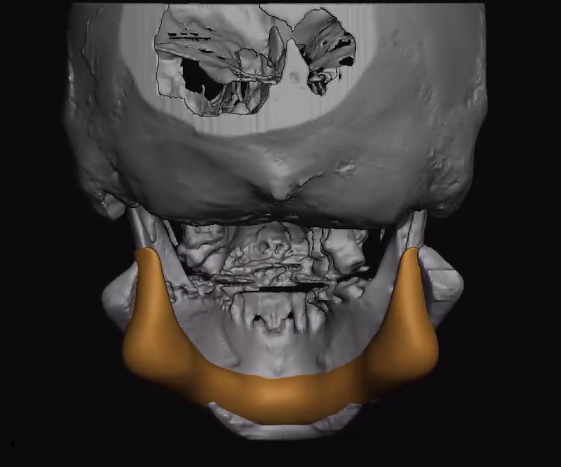 Vetical L