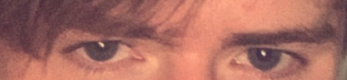 Eyearea