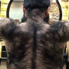 minoxidil overdose 2.jpeg