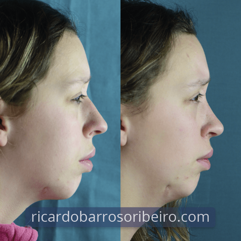 Perfil Dto 1