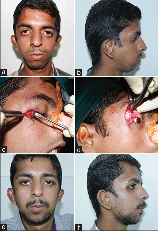 81711271 9813 4E9C 9D23 43119453CBB2