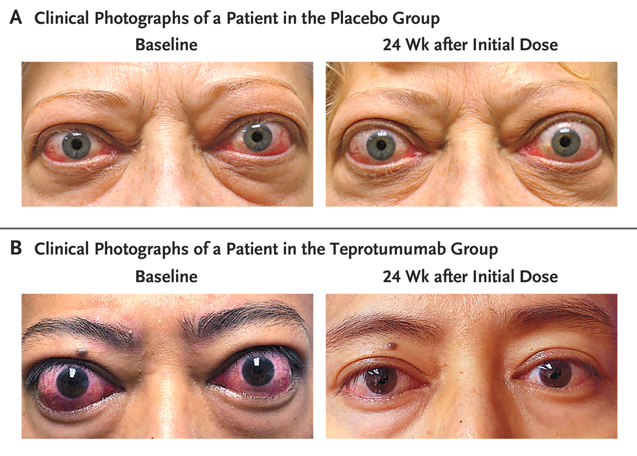 D44C4246 EE33 4F91 A427 408A93F9E61D