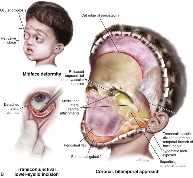 C4887471 3F3A 4E4C B696 41D62F64D5F7