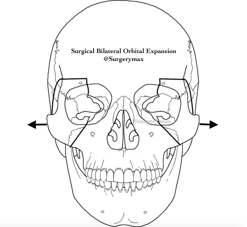 54171F91 B102 45DE B465 27B2BBD21894