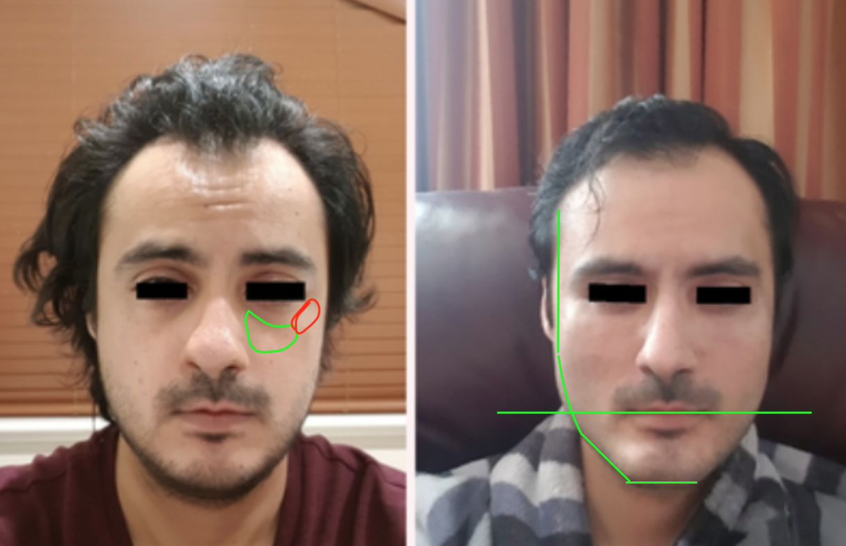 Real self man 2