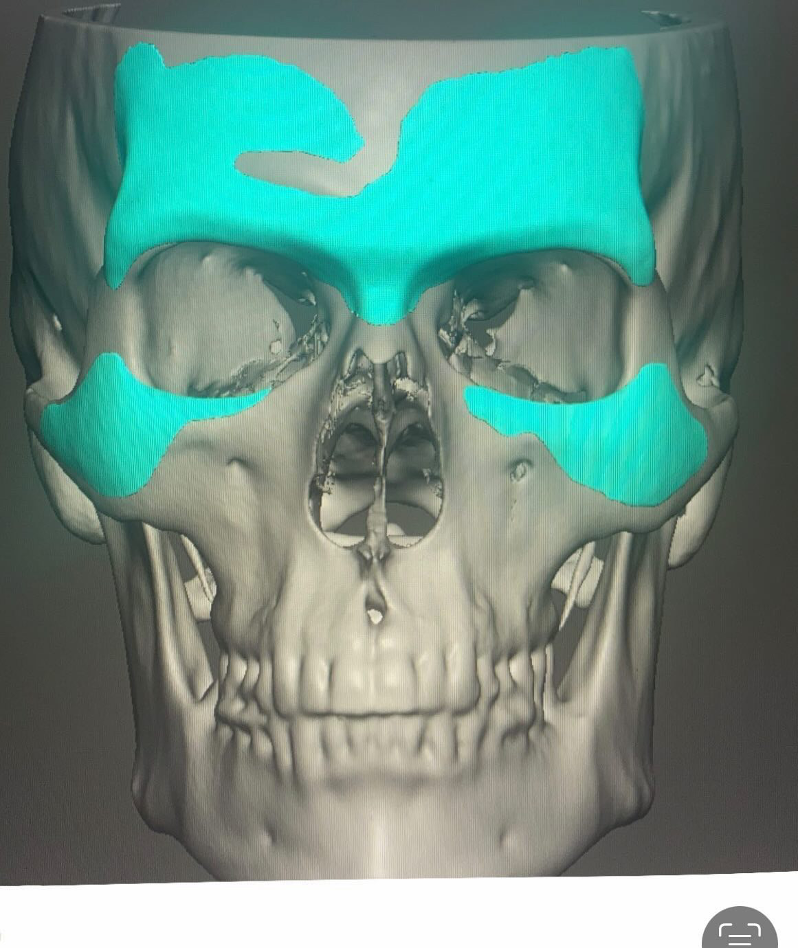 21B7DF99 B17D 423F 8817 B2B8BBA7A619