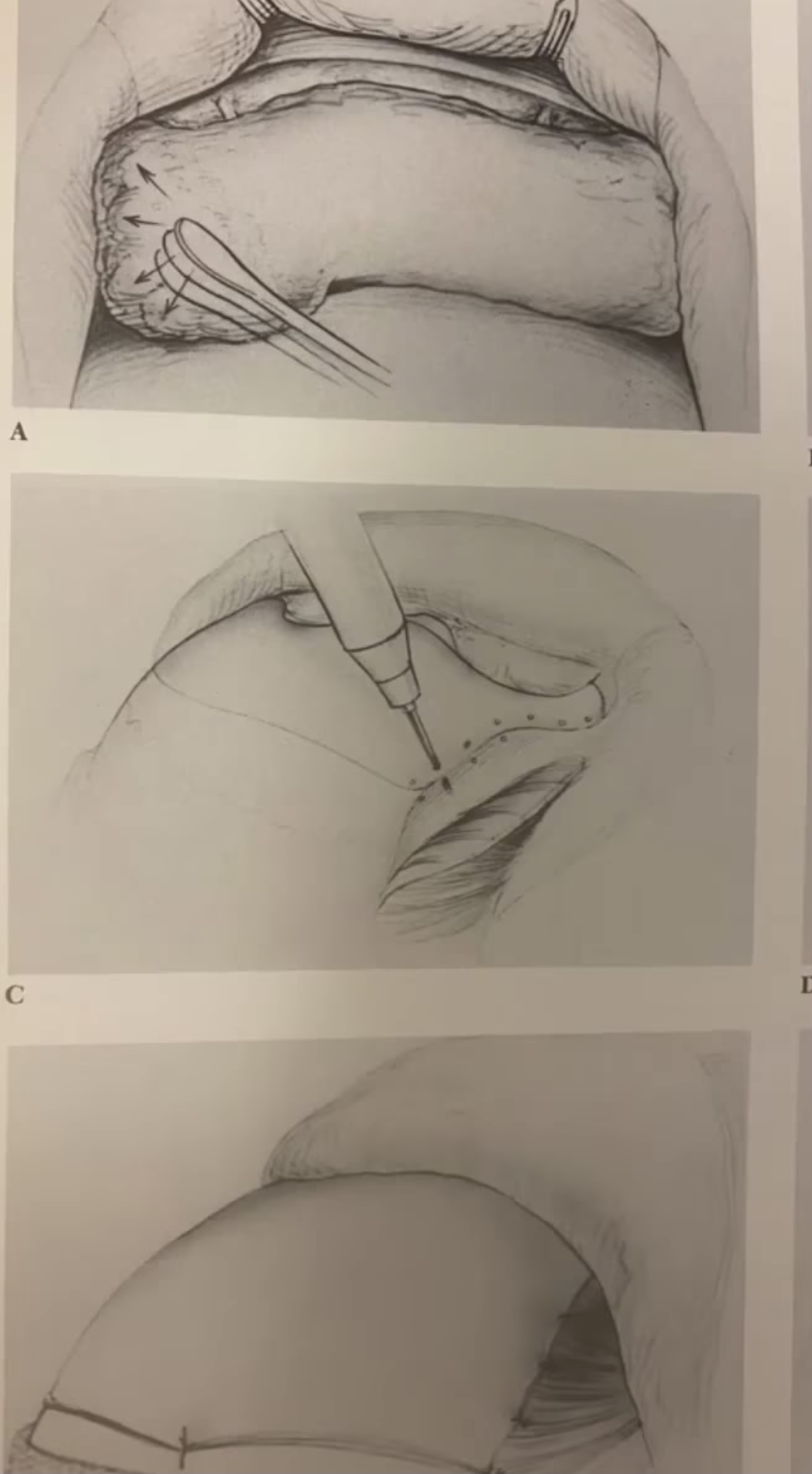 D1828870 D928 4916 A0EA D88D038369F7