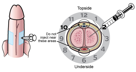 3 penis clock 450