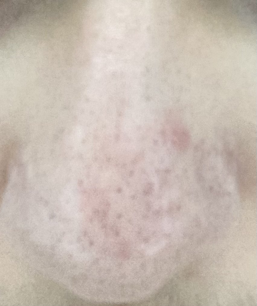1658199515917