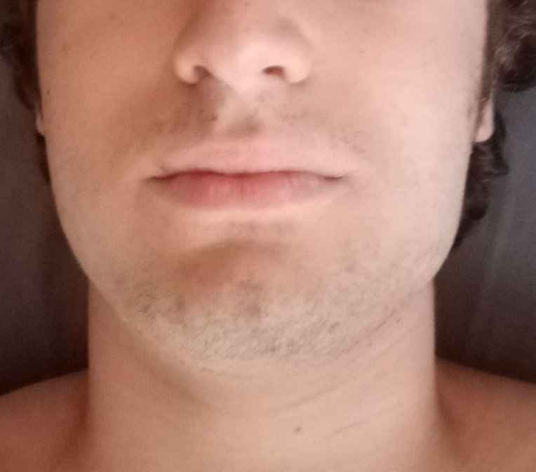 Zeb2 2