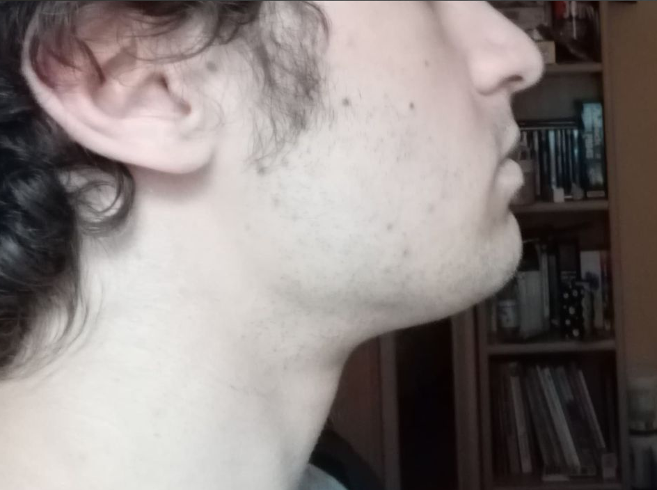 Zeb2 5