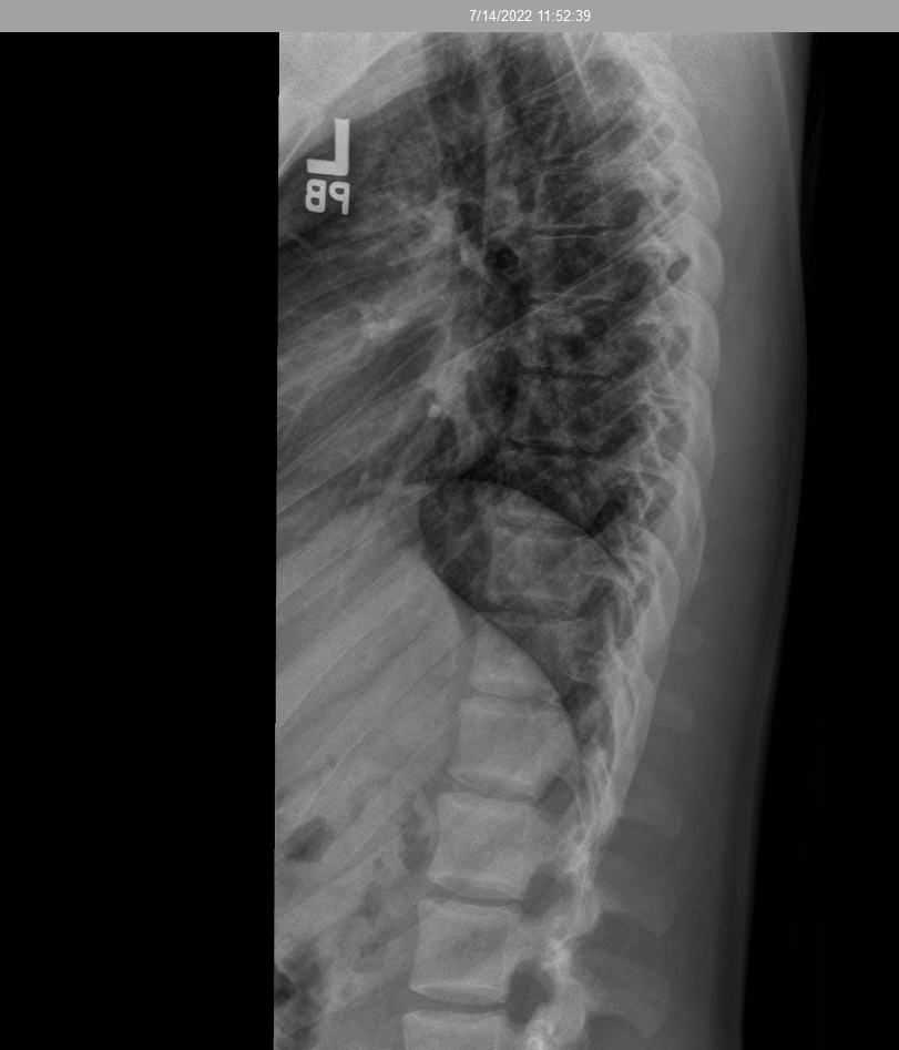 2991132 spine2