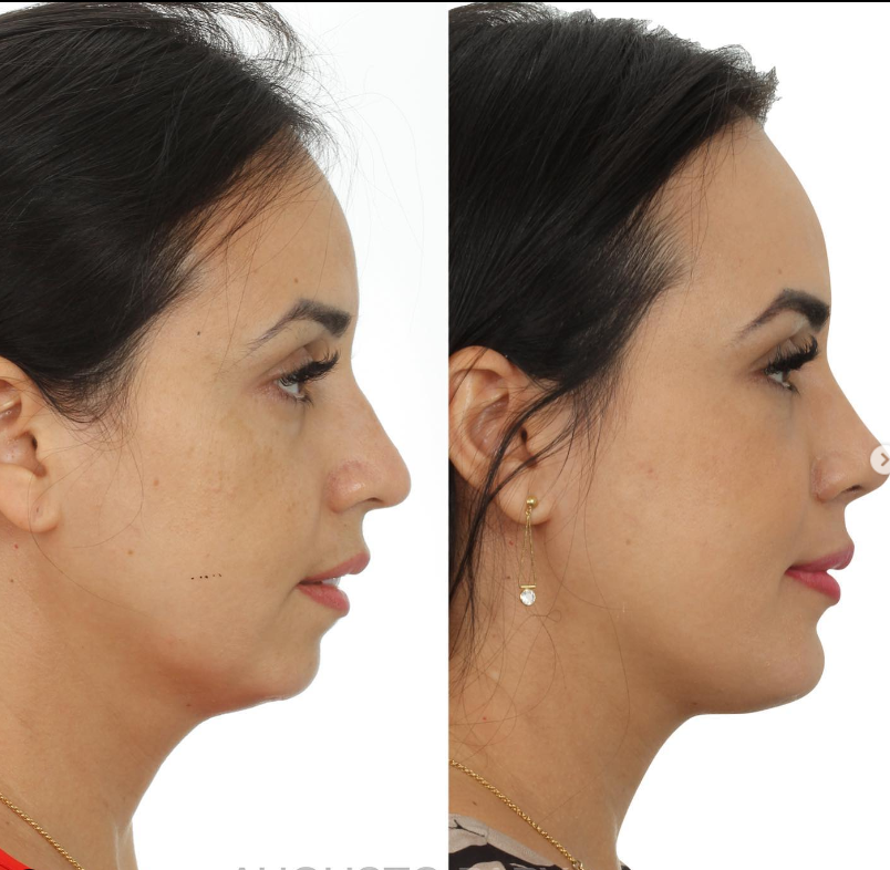 Sem asdasdas   Copia