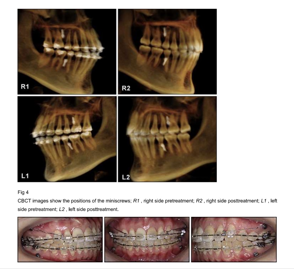 Case 2
