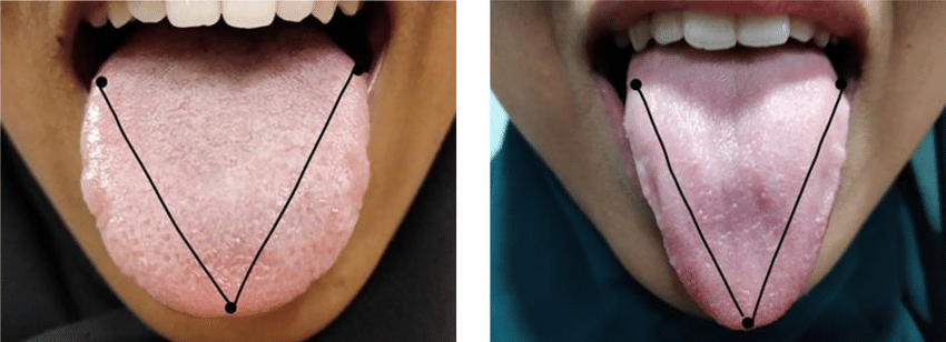 Tongue shape
