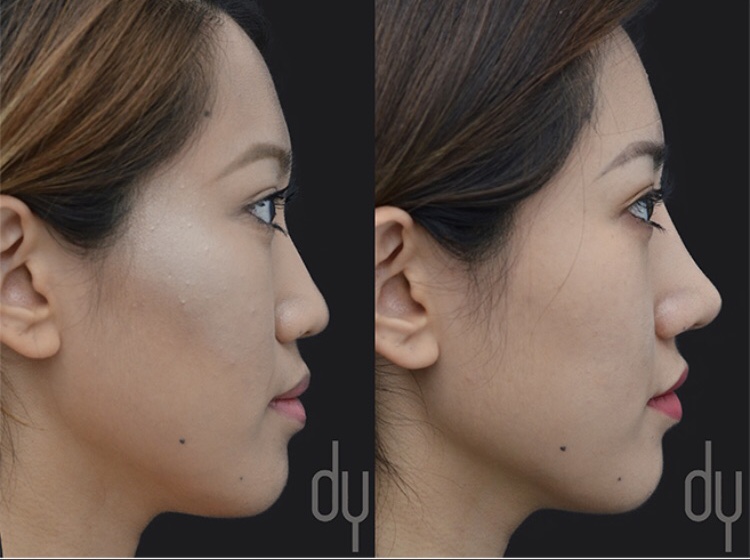 B96DA888 F7F0 470A 9DB0 AD3756AD79CF