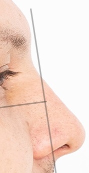 Nose morphed