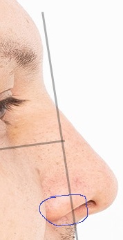 Nose morphed 2