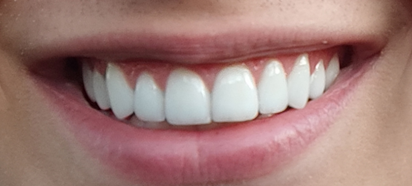 IMG 20220729 200440