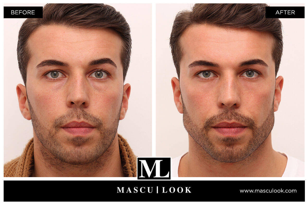 Mascu look 6