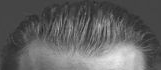 Hairline