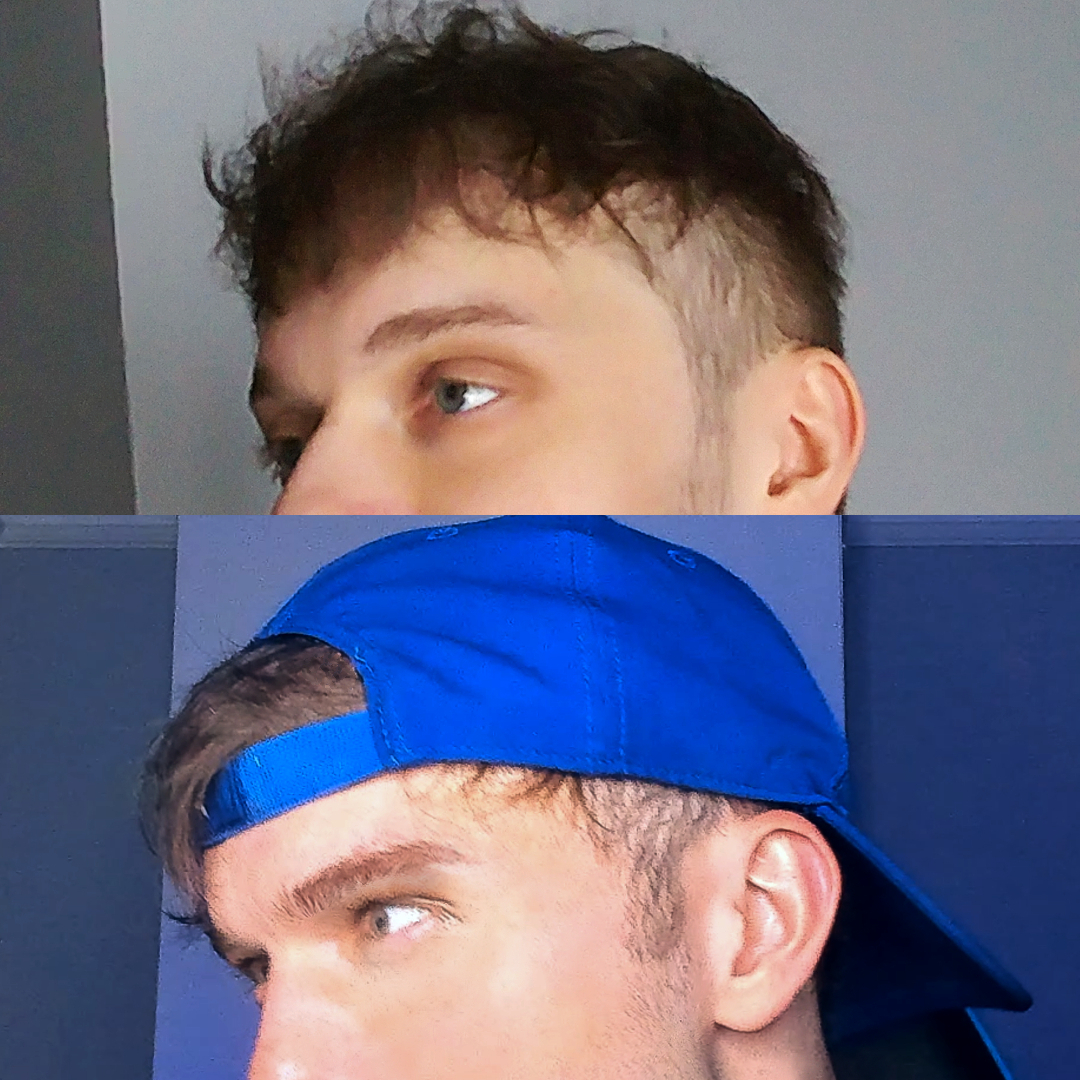 Eye improvement