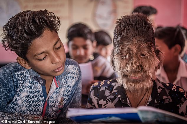 9555886 6682253 Lalit is very popular in class and everyone is fond of him the h a 64 15496437