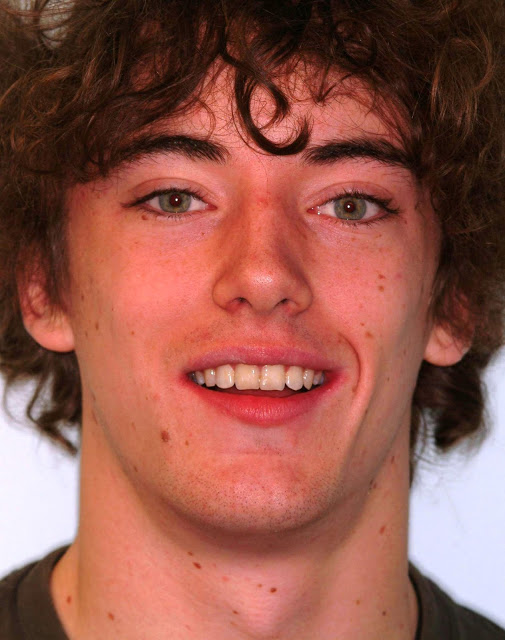Orthodontic23